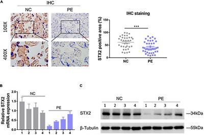 STX2 Promotes Trophoblast Growth, Migration, and Invasion Through Activation of the PI3K-AKT Pathway in Preeclampsia